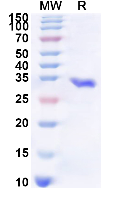 SDS-PAGE for Recombinant Human NCOA2 Protein, N-His