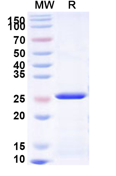 SDS-PAGE for Recombinant Human NCR1 Protein, N-His