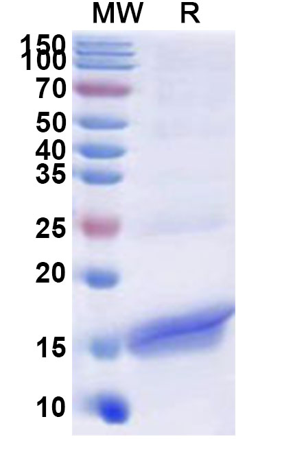 SDS-PAGE for Recombinant Human NCR2 Protein, N-His