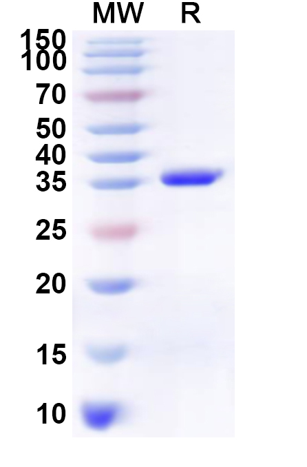 SDS-PAGE for Recombinant Human NEXMIF Protein, N-His-KSI