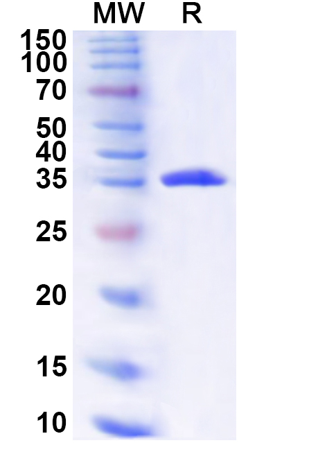 SDS-PAGE for Recombinant Human NFATC4 Protein, N-His