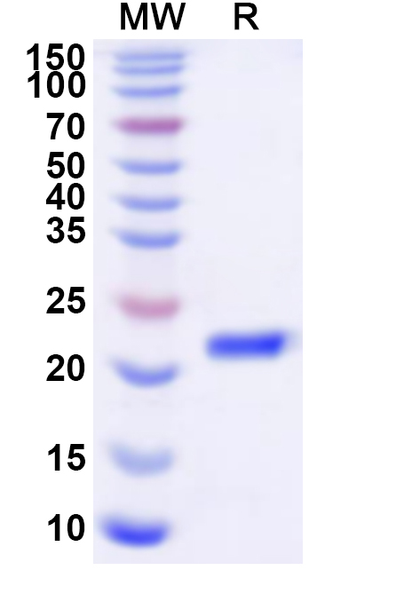 SDS-PAGE for Recombinant Human NFYB Protein, N-His