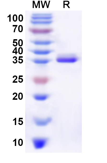 SDS-PAGE for Recombinant Human NHLH2 Protein, N-His-KSI