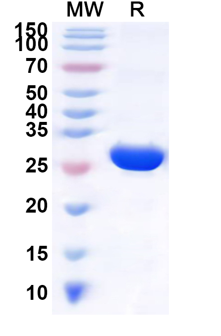 SDS-PAGE for Recombinant Human NKG7 Protein, N-GST & C-His