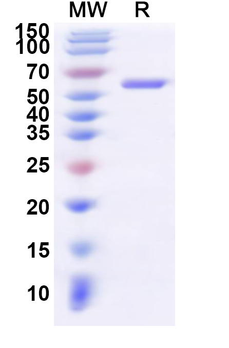 SDS-PAGE for Recombinant Human NKX3-2 Protein, N-His-KSI