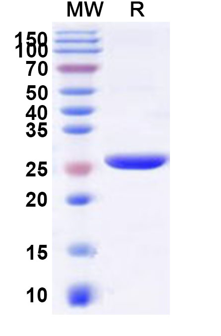 SDS-PAGE for Recombinant Human NMRK1 Protein, N-His