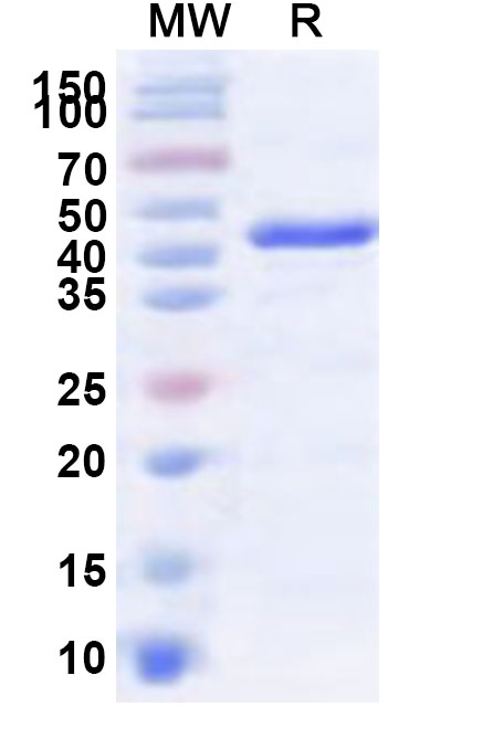 SDS-PAGE for Recombinant Human NOP2 Protein, N-His