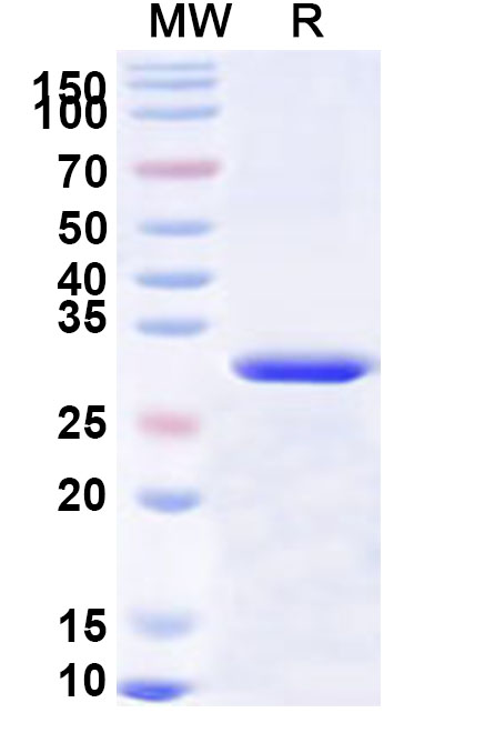 SDS-PAGE for Recombinant Human NUAK2 Protein, N-His