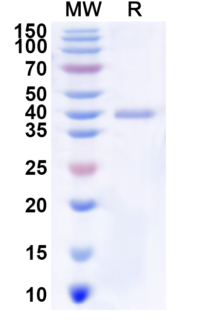 SDS-PAGE for Recombinant Human NUBP1 Protein, N-His