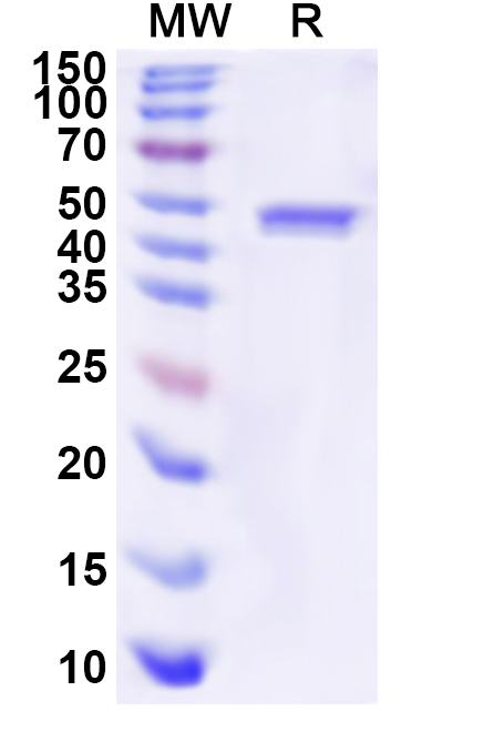 SDS-PAGE for Recombinant Human NUP214 Protein, N-His