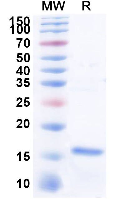 SDS-PAGE for Recombinant Human NXF1 Protein, N-His