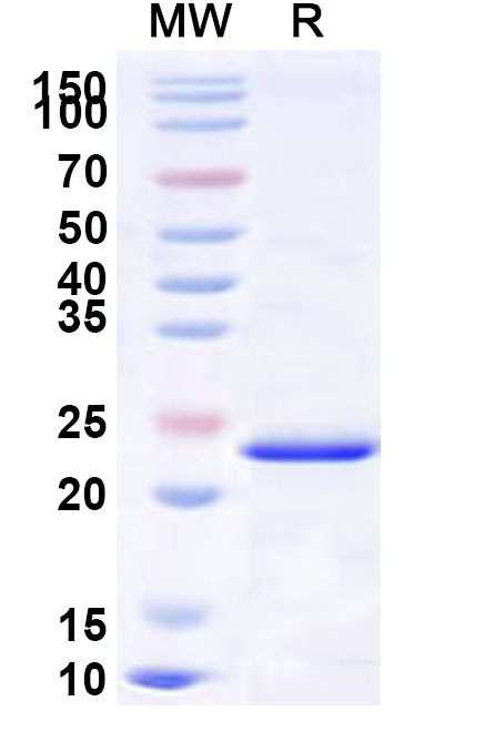SDS-PAGE for Recombinant Human ONECUT2 Protein, N-His