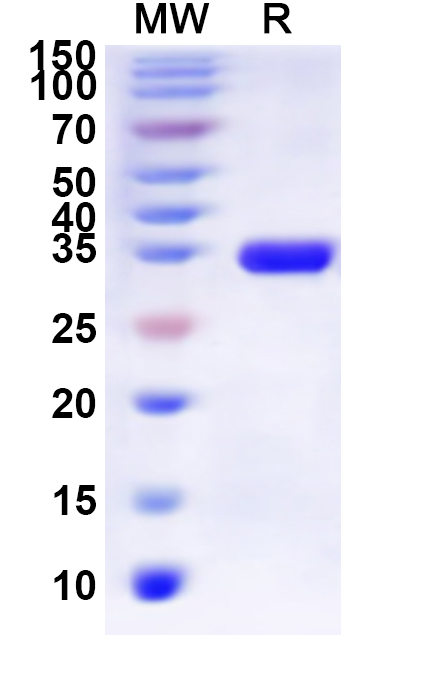 SDS-PAGE for Recombinant Human OPRD1 Protein, N-His-KSI