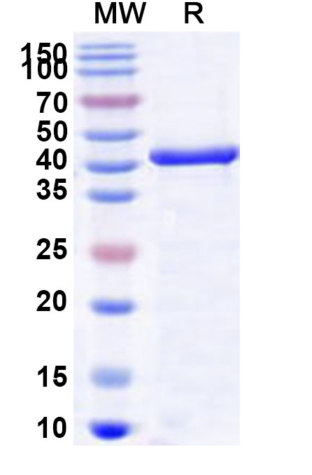 SDS-PAGE for Recombinant Human ORC4 Protein, N-His