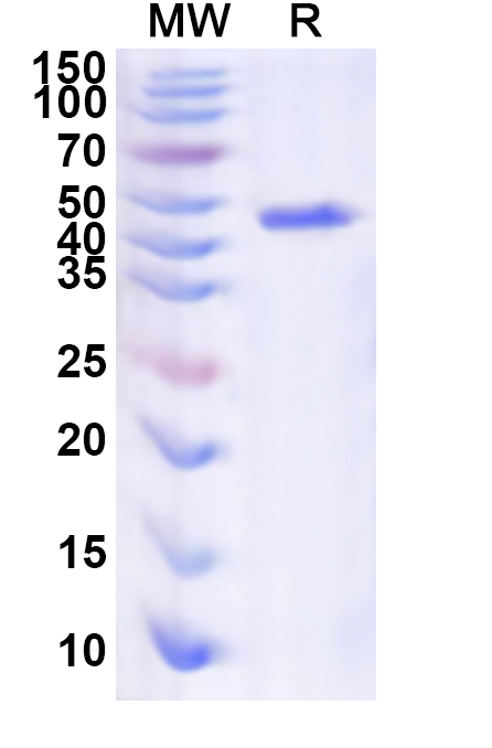 SDS-PAGE for Recombinant Human OTOF Protein, N-His