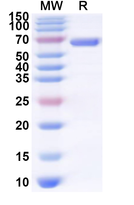 SDS-PAGE for Recombinant Human OTUD1 Protein, N-His