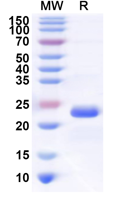 SDS-PAGE for Recombinant Human OTUD3 Protein, N-His