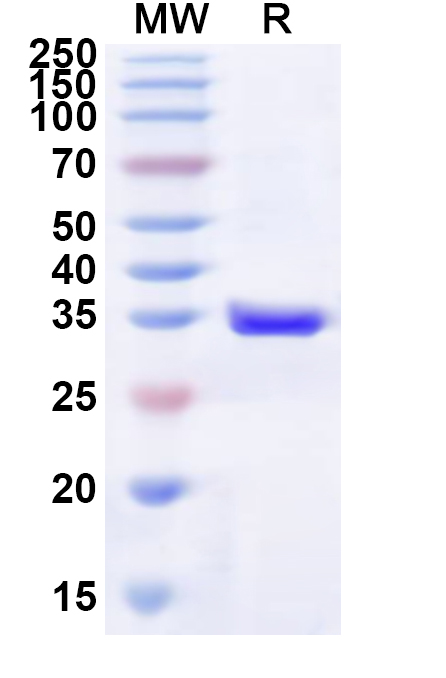 SDS-PAGE for Recombinant Human P2RY1 Protein, N-His-KSI