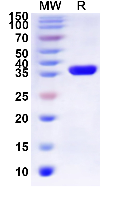 SDS-PAGE for Recombinant Human P2RY2 Protein, N-His-KSI