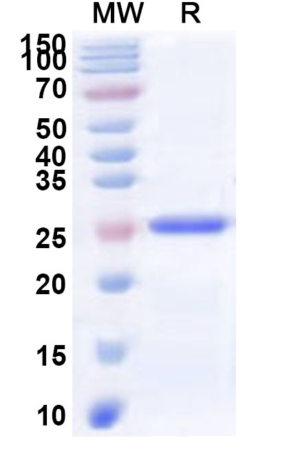 SDS-PAGE for Recombinant Human PACC1 Protein, N-His