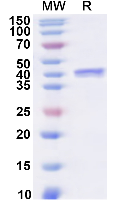 SDS-PAGE for Recombinant Human PAFAH1B1 Protein, N-His