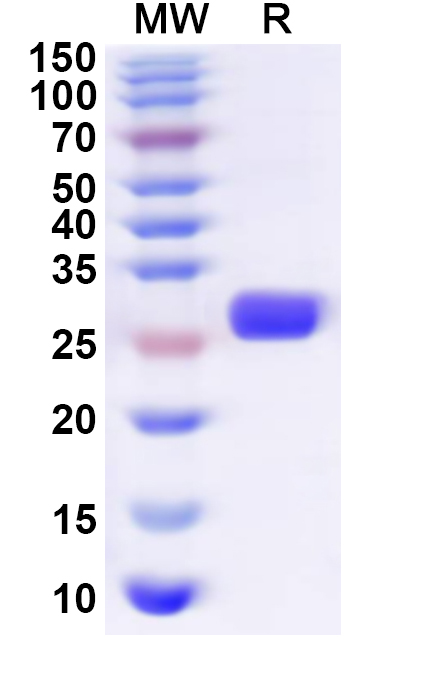 SDS-PAGE for Recombinant Human PAFAH1B2 Protein, N-His