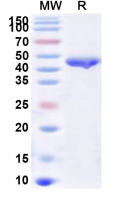 SDS-PAGE for Recombinant Human PAPSS2 Protein, N-His