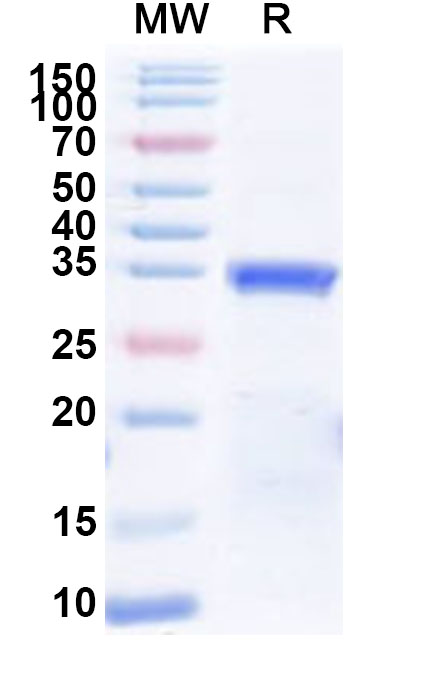 SDS-PAGE for Recombinant Human PAX3 Protein, N-His