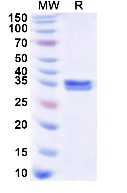 SDS-PAGE for Recombinant Human PBLD Protein, N-His