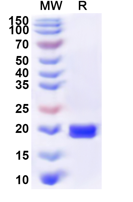 SDS-PAGE for Recombinant Human PCYT1A Protein, N-His