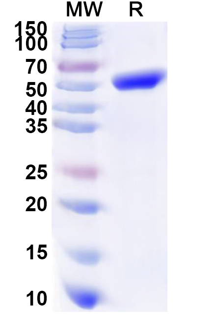 SDS-PAGE for Recombinant Human PDHA2 Protein, N-His