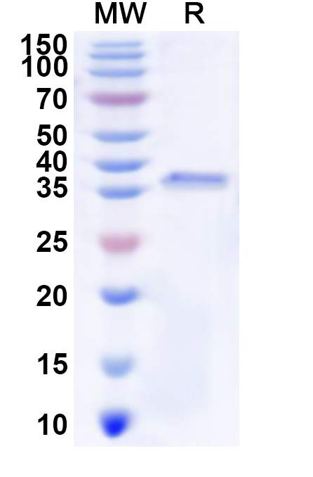 SDS-PAGE for Recombinant Human PDLIM4 Protein, N-GST & C-His
