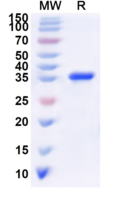 SDS-PAGE for Recombinant Human PER3 Protein, N-His