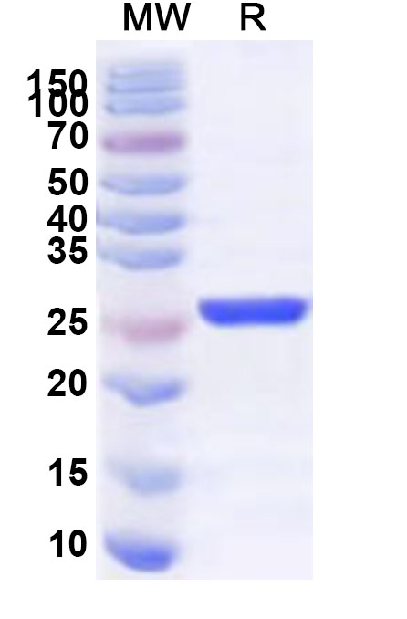 SDS-PAGE for Recombinant Human PGAM5 Protein, N-His