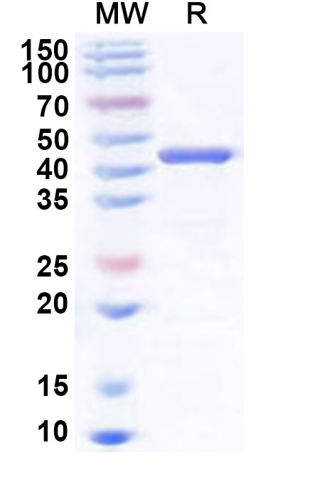 SDS-PAGE for Recombinant Human PHF2 Protein, N-His