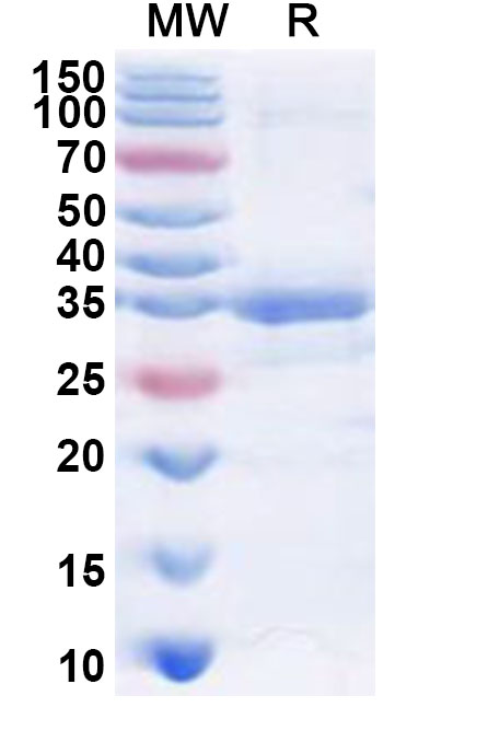 SDS-PAGE for Recombinant Human PHKG1 Protein, N-His