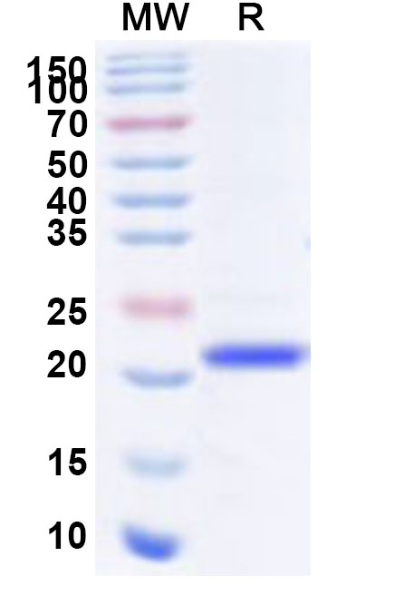 SDS-PAGE for Recombinant Human PHLDA2 Protein, N-His