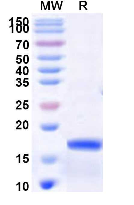 SDS-PAGE for Recombinant Human PHLPP2 Protein, N-His