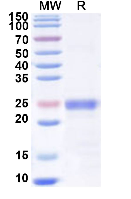SDS-PAGE for Recombinant Human PI16 Protein, N-His