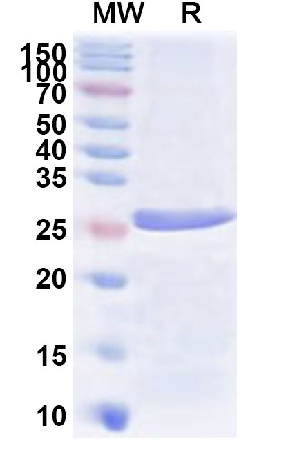SDS-PAGE for Recombinant Human PKIA Protein, N-His-KSI