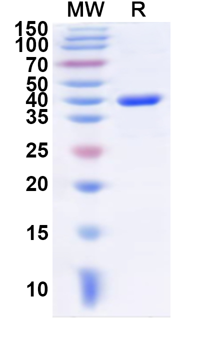 SDS-PAGE for Recombinant Human PLCB4 Protein, N-His