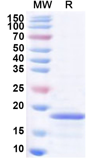 SDS-PAGE for Recombinant Human PLEKHS1 Protein, N-His