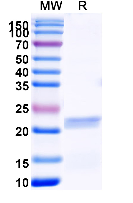 SDS-PAGE for Recombinant Human PLK1, N-His