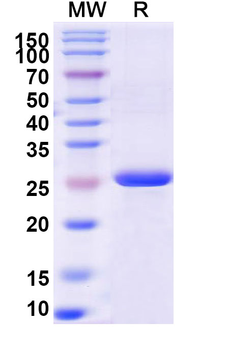 SDS-PAGE for Recombinant Human PLOD2 Protein, N-His