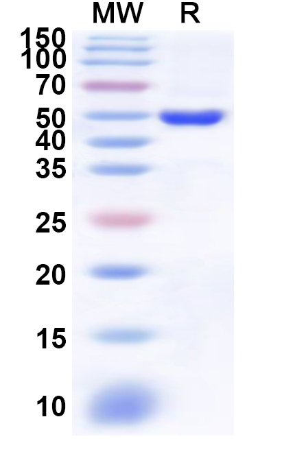 SDS-PAGE for Recombinant Human PMPCA Protein, N-His