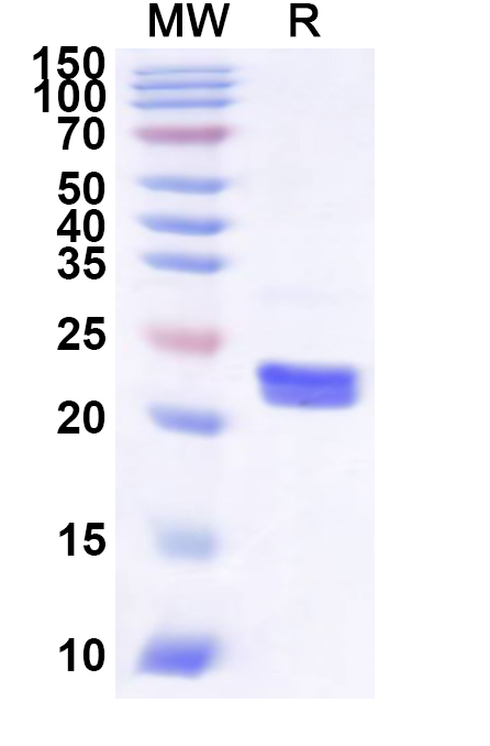 SDS-PAGE for Recombinant Human PMVK Protein, N-His