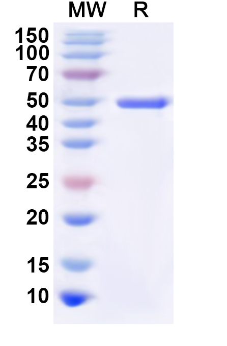 SDS-PAGE for Recombinant Human PNLIP Protein, N-His