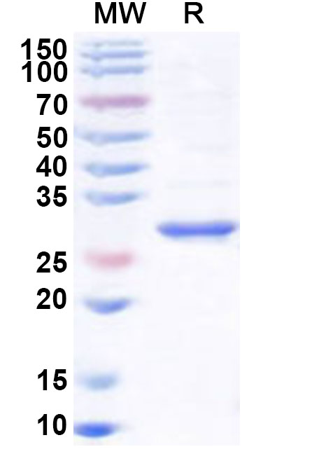 SDS-PAGE for Recombinant Human PNMT Protein, N-His