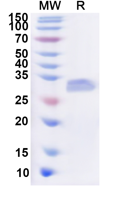 SDS-PAGE for Recombinant Human PNPLA4 Protein, N-His