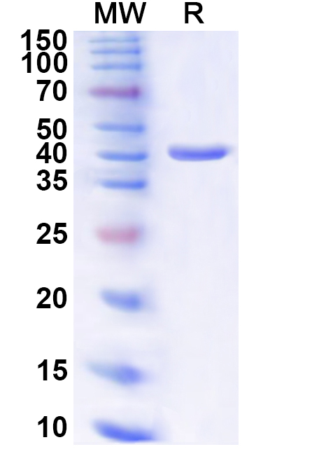 SDS-PAGE for Recombinant Human POLA2 Protein, N-His